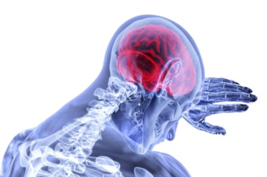 x-ray of a traumatic brain injury